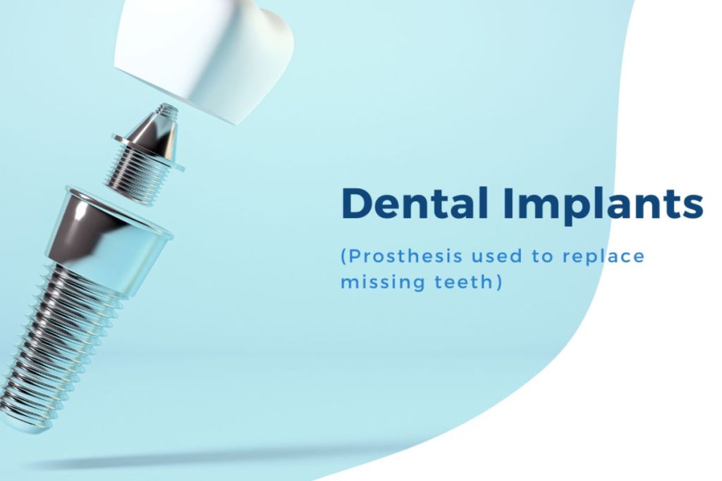 Medical Tourism Dental Implants Retired Working For You